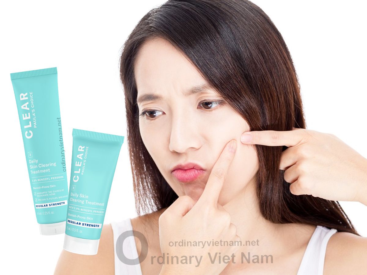 Kem cham mun Paula's Choice Clear Regurlar Strength Daily Skin Ordinary Viet Nam