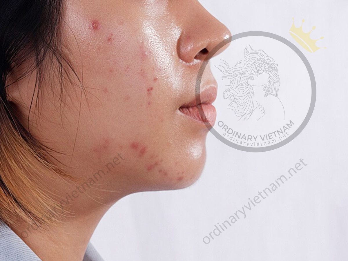 Review-sua-rua-mat-Cerave-renewing-sa-cleanser-co-tot-nhu-loi-don